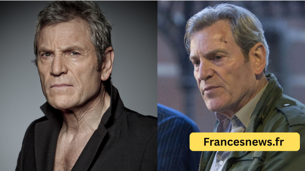 Tcheky Karyo Bras Paralyse